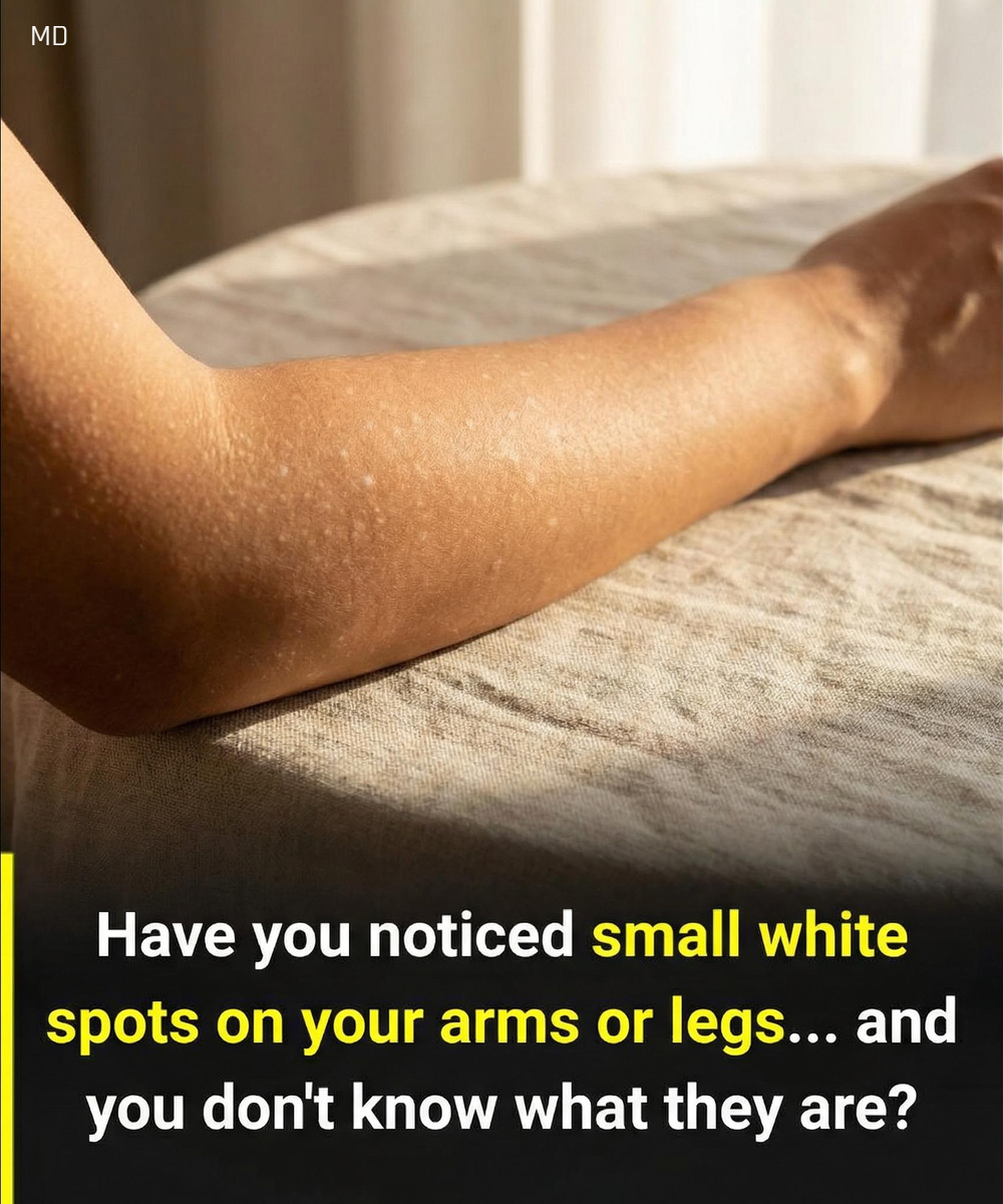 What Small White Spots on Your Arms or Legs Could Mean